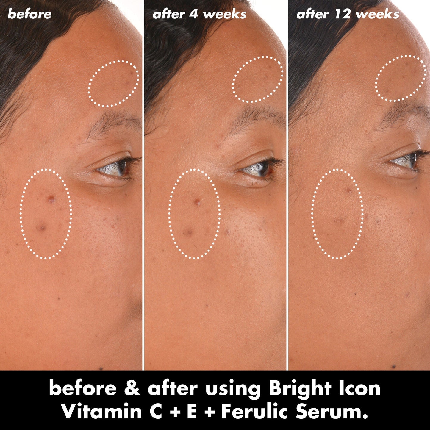 bright-icon-vitamin-c-e-ferulic-serum-n6 0226_EDU_BrightIconVitC_BA_Chanel_TRIPTYCH_c58f2fc8-209d-414f-9ba3-666a07a94887.jpg