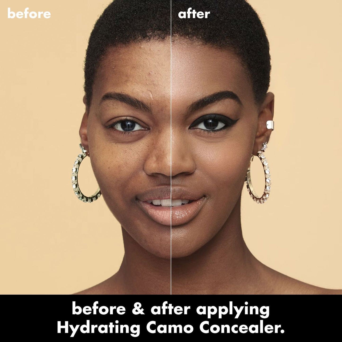 hydrating-camo-concealer-j3 0226_EDU_HydratingCamoConcelaer_BA_AshleyKaresh_20_1_d8499bbf-0e91-4173-b5e2-75127caf83a3.jpg