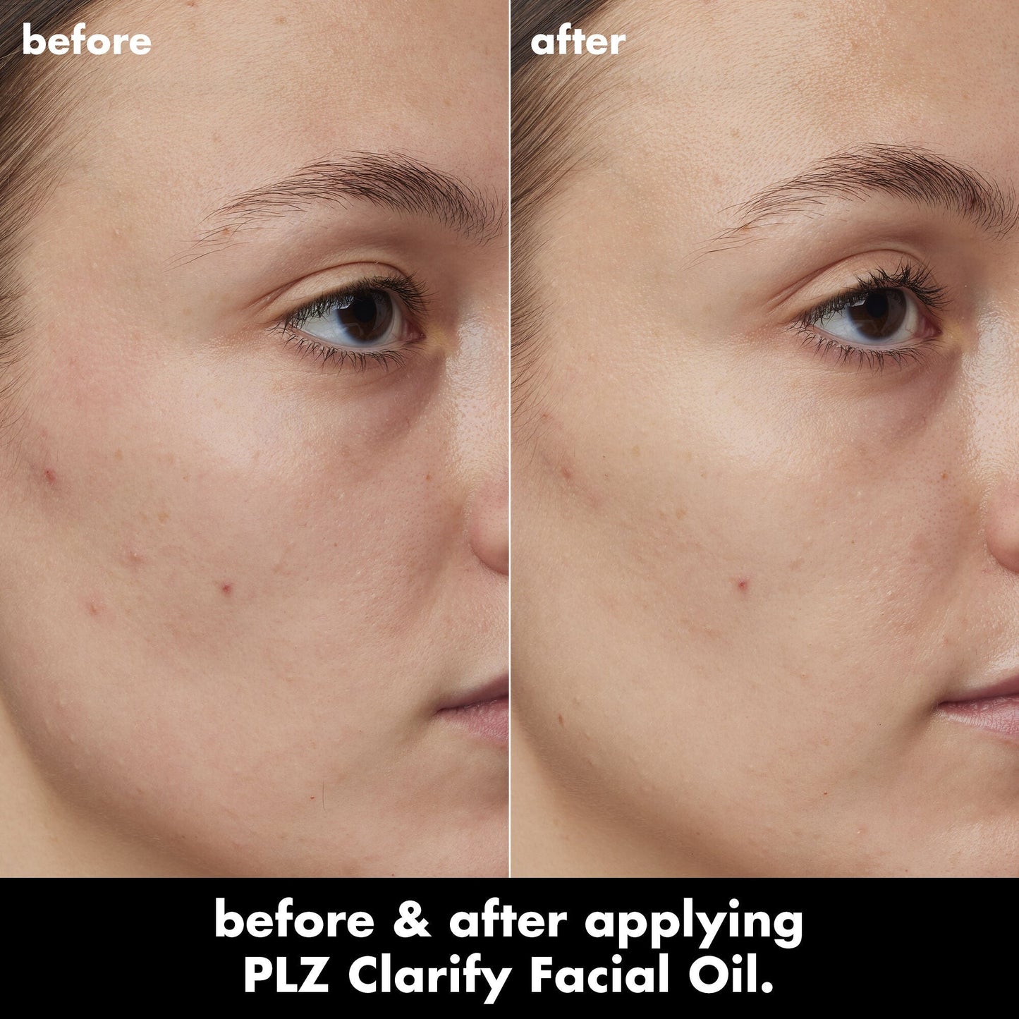 plz-clarify-facial-oil-q2 0326_EDU_PlzClarify_BA_Kelly.jpg