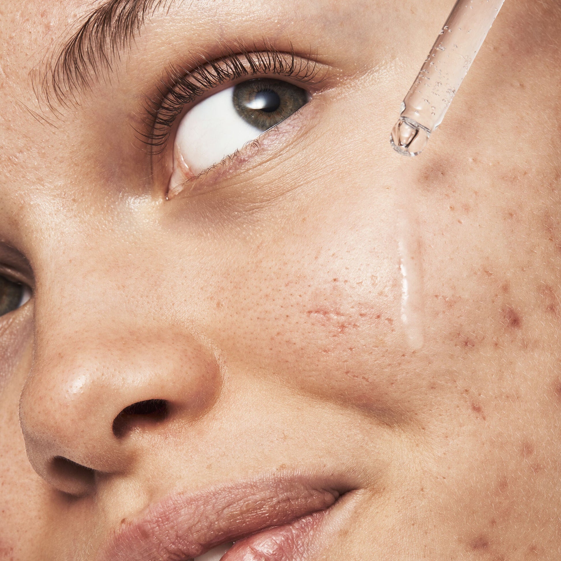 blemish-breakthrough-triple-acid-resurfacing-serum-s1 121321_Marley-Acne-Regimen_0254_FINAL_IGF.jpg