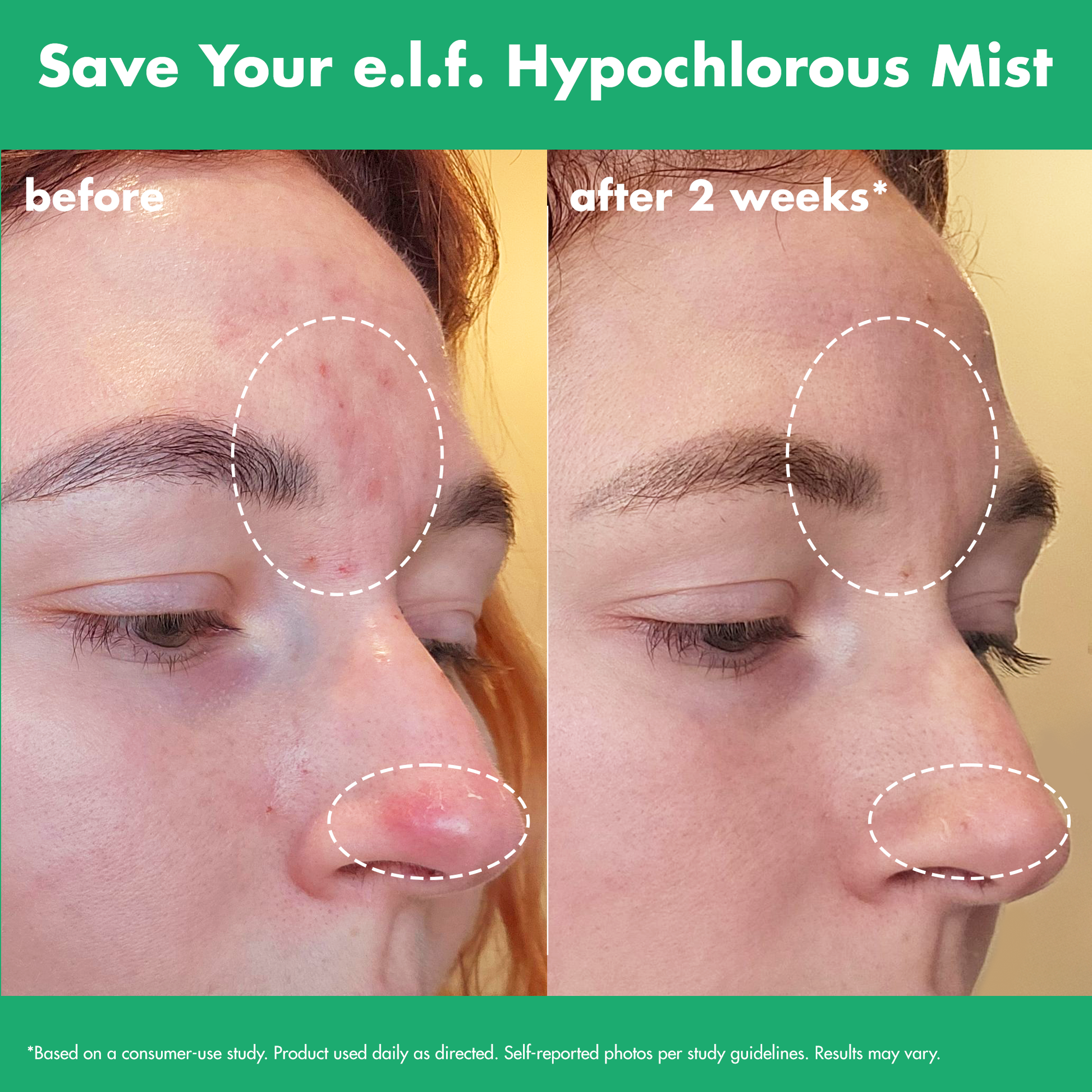 save-your-e-l-f-hypochlorous-mist-q3 FA26_EDUCATION_SAVEYOURELF_USAGE_BA1_WITHOUT_CLAIMS.png