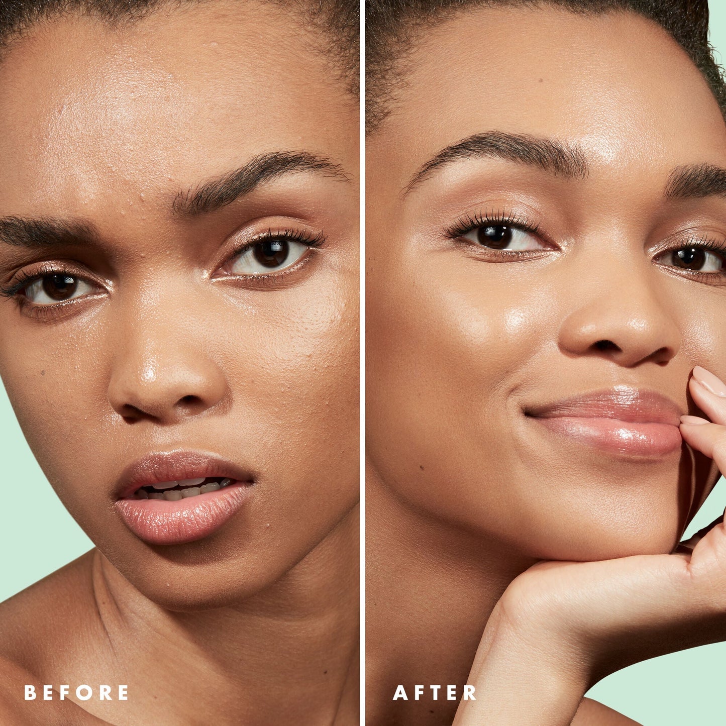 blemish-control-face-primer-small-size-l1 Primer_PP_Before_After_BlemishControl_2000x2000_1b657297-1b62-4427-874a-10c706535581.jpg
